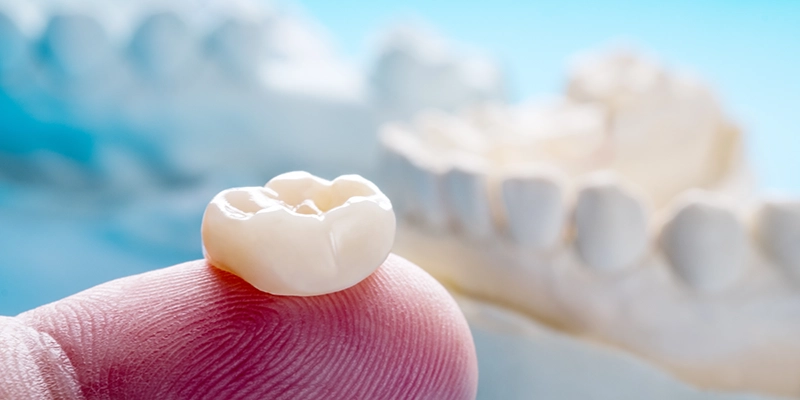 Dental Crowns in Boca Raton, FL